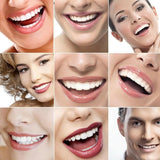 Snap On Veneers Instant Adjustable Bottom And Upper Dentures