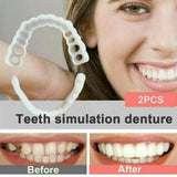 Snap On Veneers Instant Adjustable Bottom And Upper Dentures